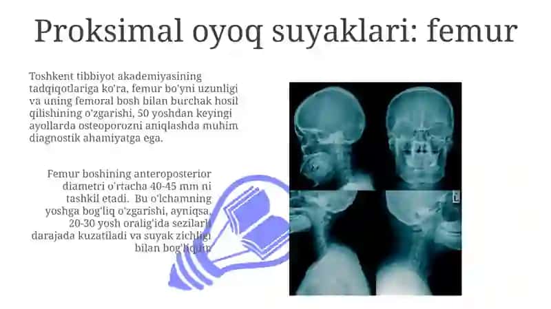 Kalla suyaklarininig rentgeno anatomiyasi 3