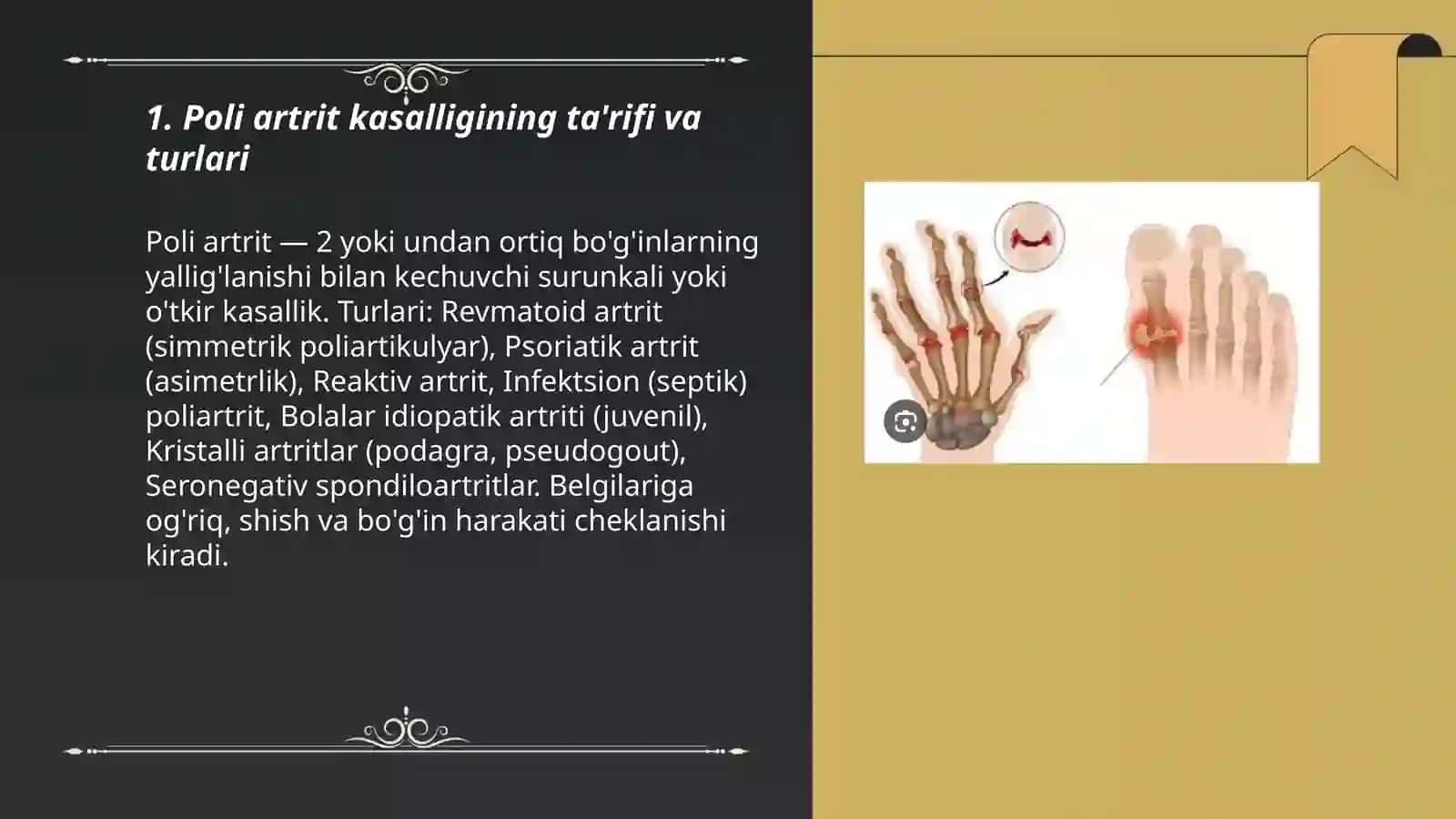 Poli artrit kassaligi 3