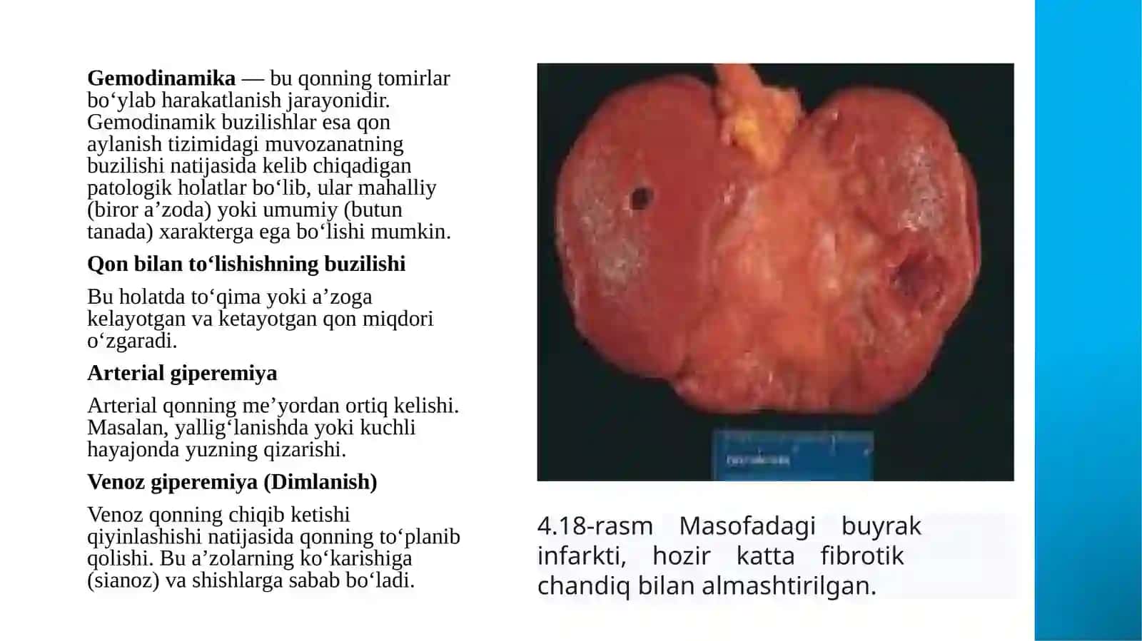 Gemodinamikbuzilishlari 3