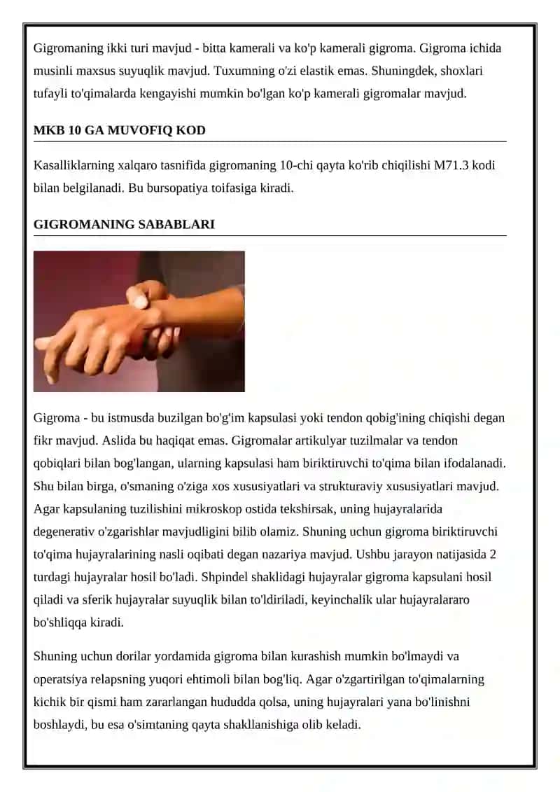Gigroma 3