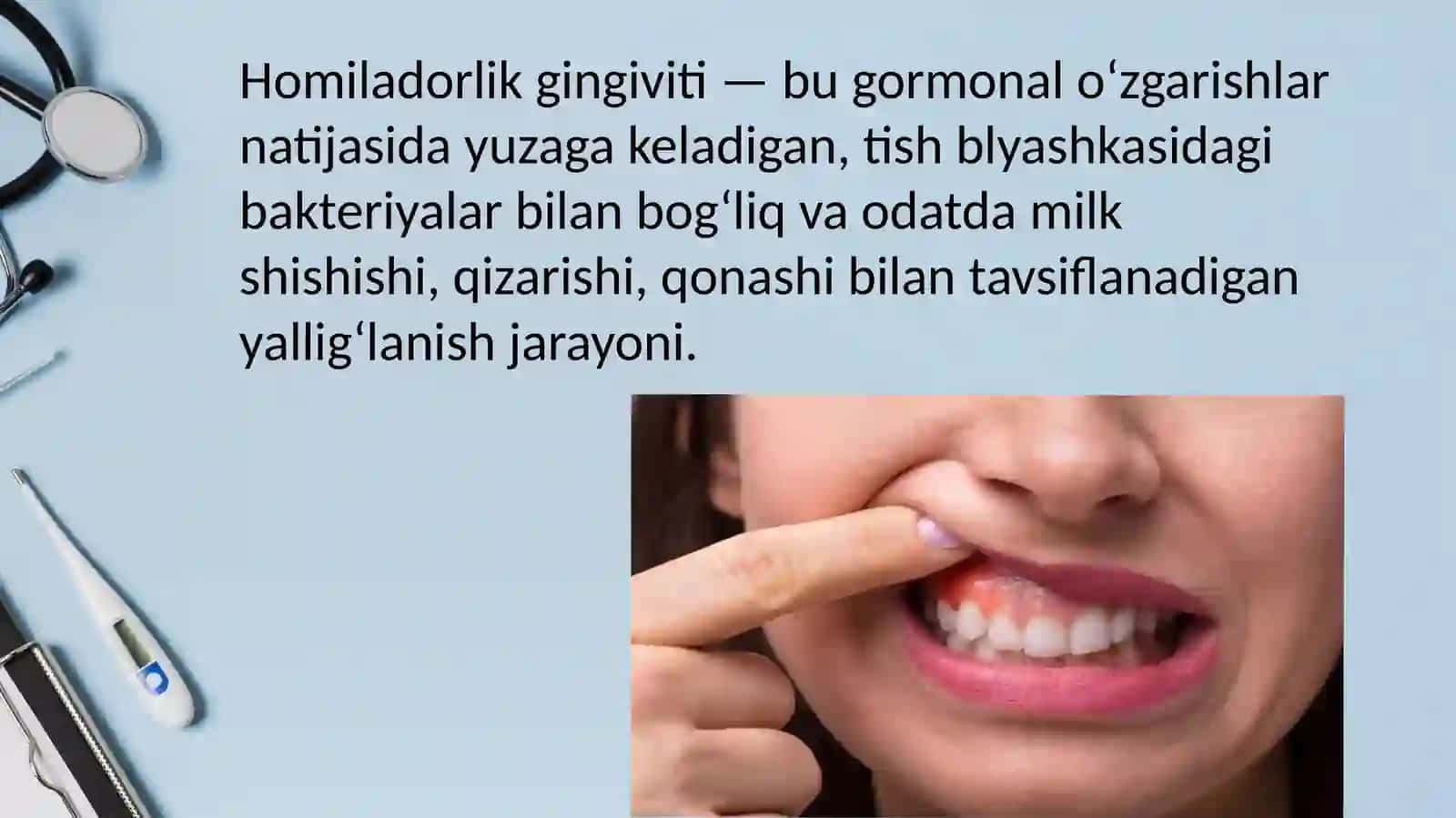 Homiladorlik gingiviti 3