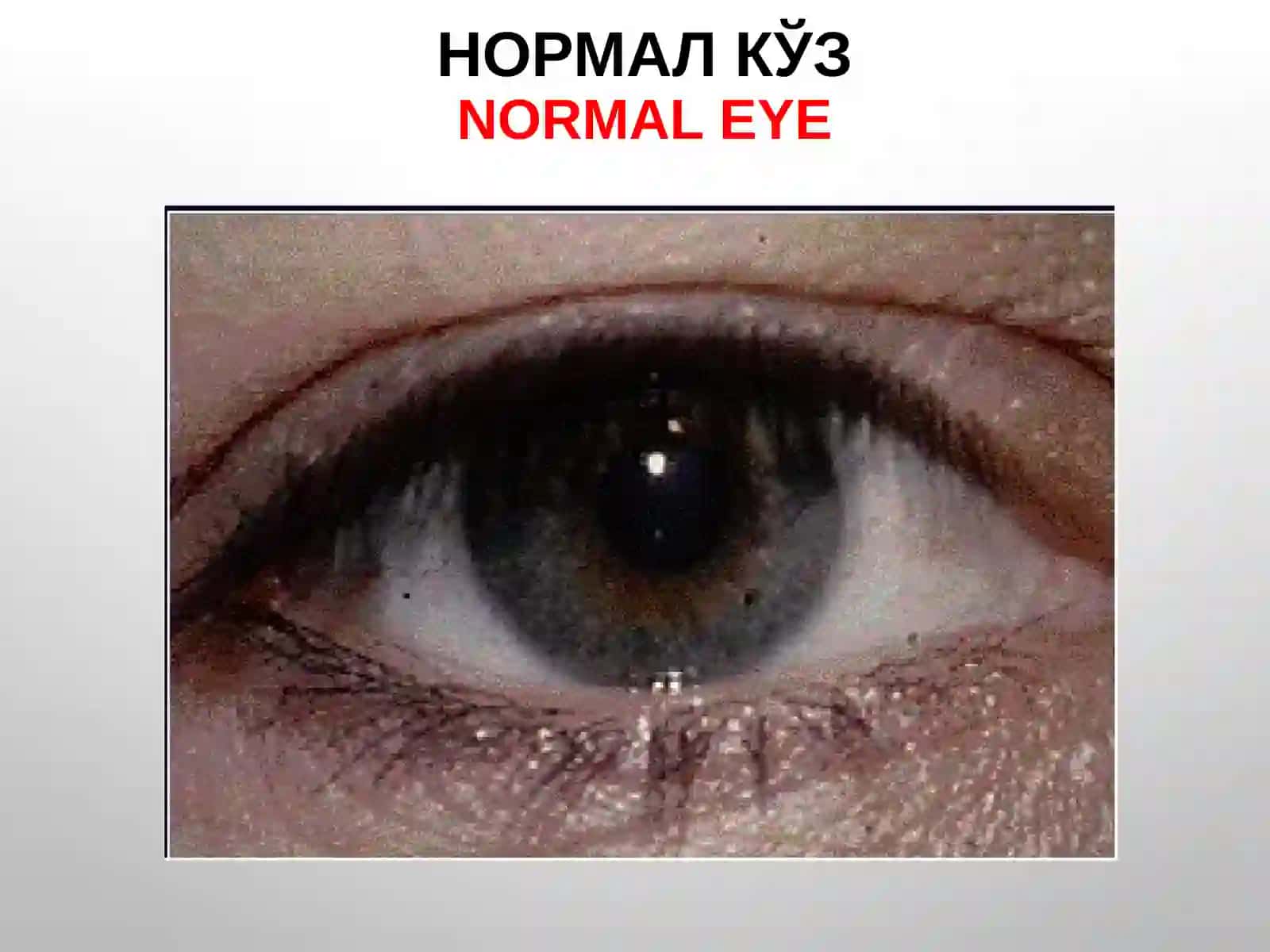 ОФТАЛЬМОЛОГИЯ кафедраси 3