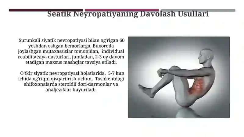Siyatik Nerv 3