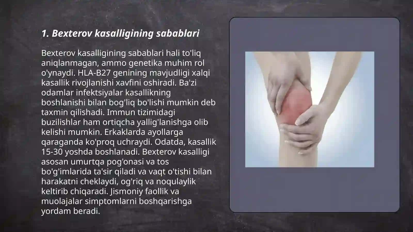 Bexterov kasalligi(autoimmun kasallik) 3