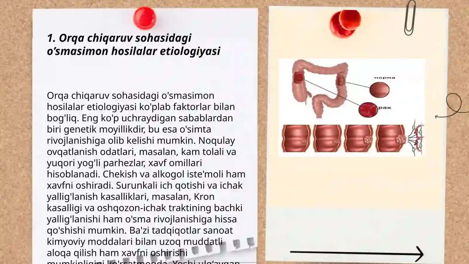Orqa chiqaruv sohasidagi o’smasimon hosilalar 3
