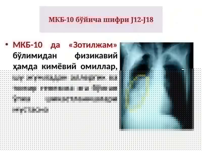 Зотилжам 3
