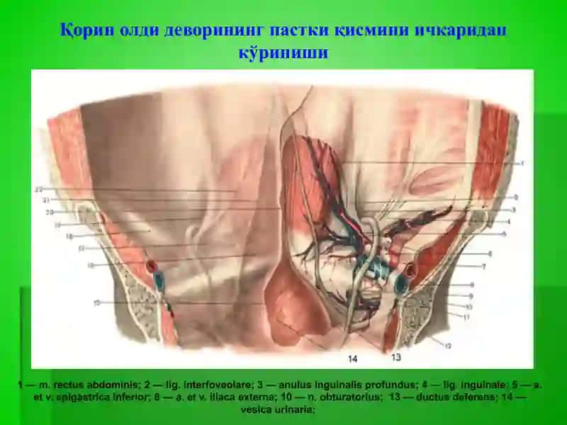 Чов, сон, киндик ва қорин оқ чизиғи чурралари 3