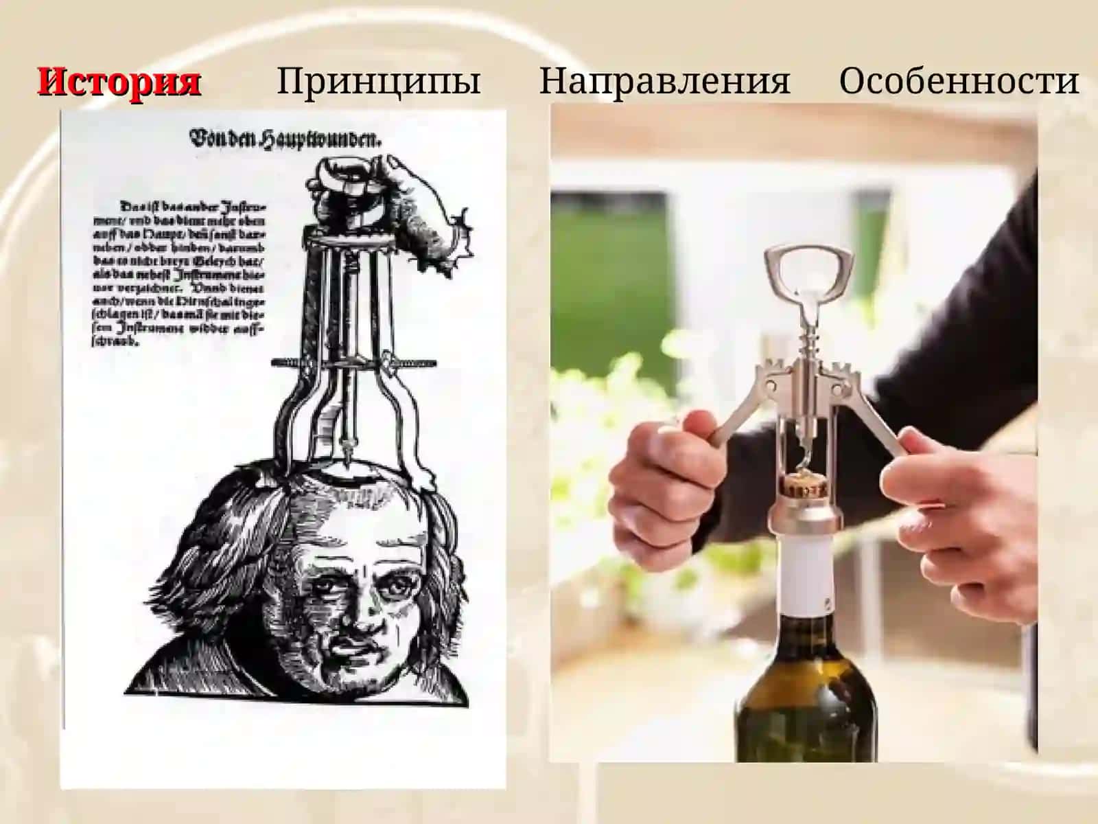 Нейрохирургия 3