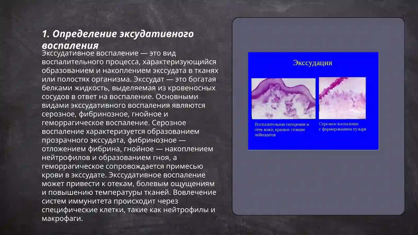 Эксудативное воспаление 3