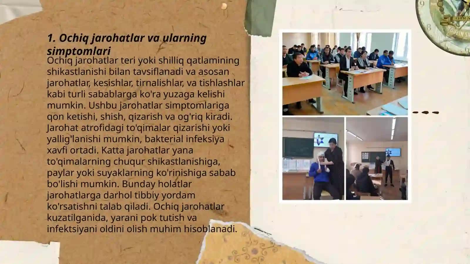 Ochiq va yopiq shikastlanishlar tramatik shok infeksiyasi 3