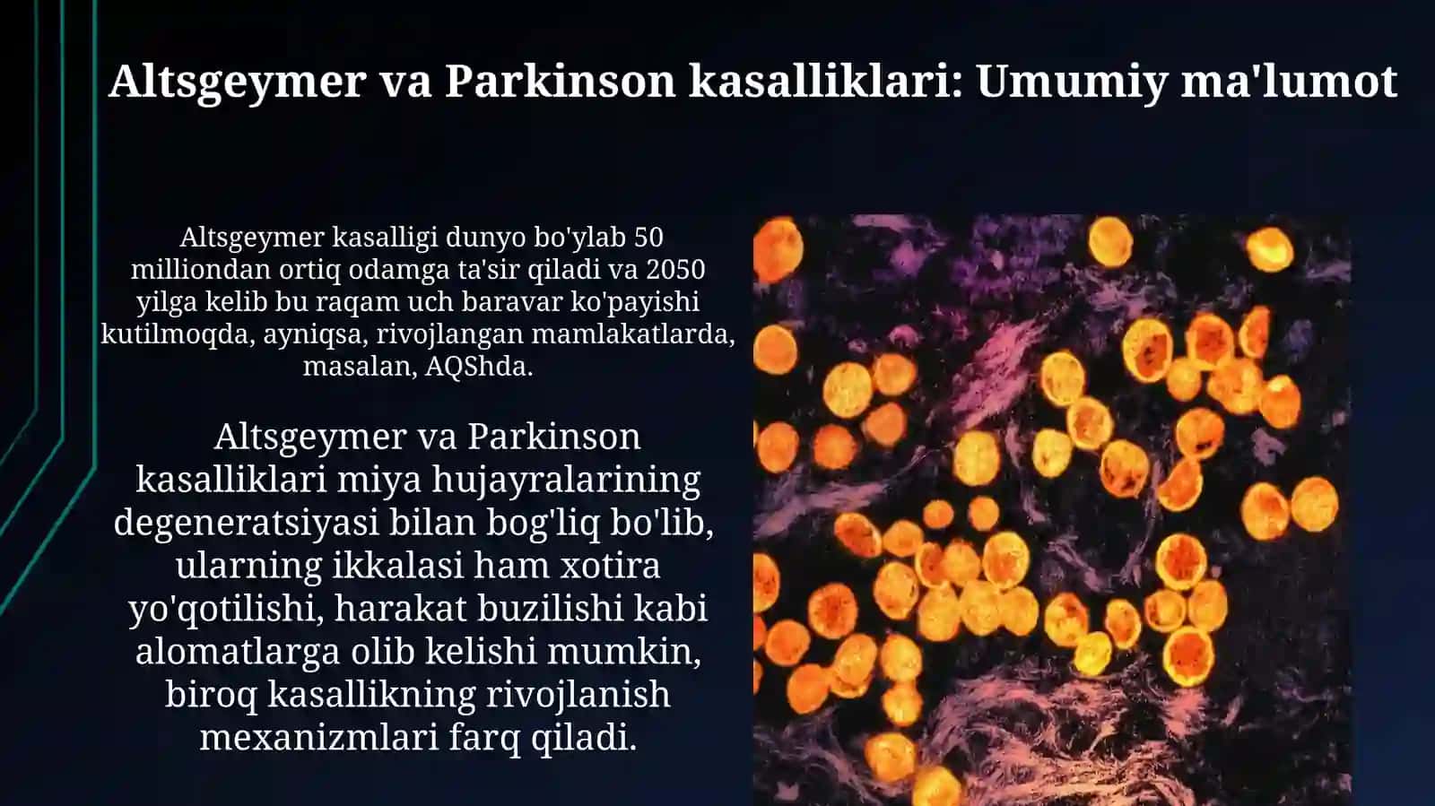 Altsgeymer va Parkinson kasalliklari 3