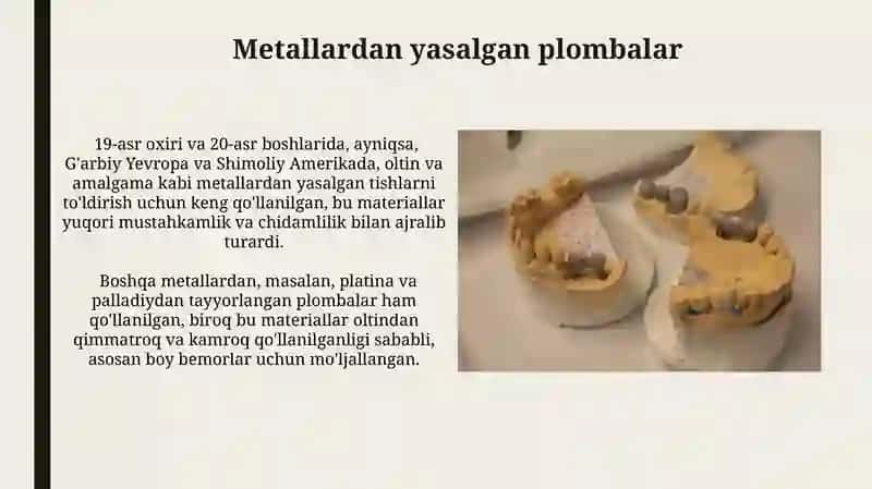 Metallardan yasalgan plombalar 3