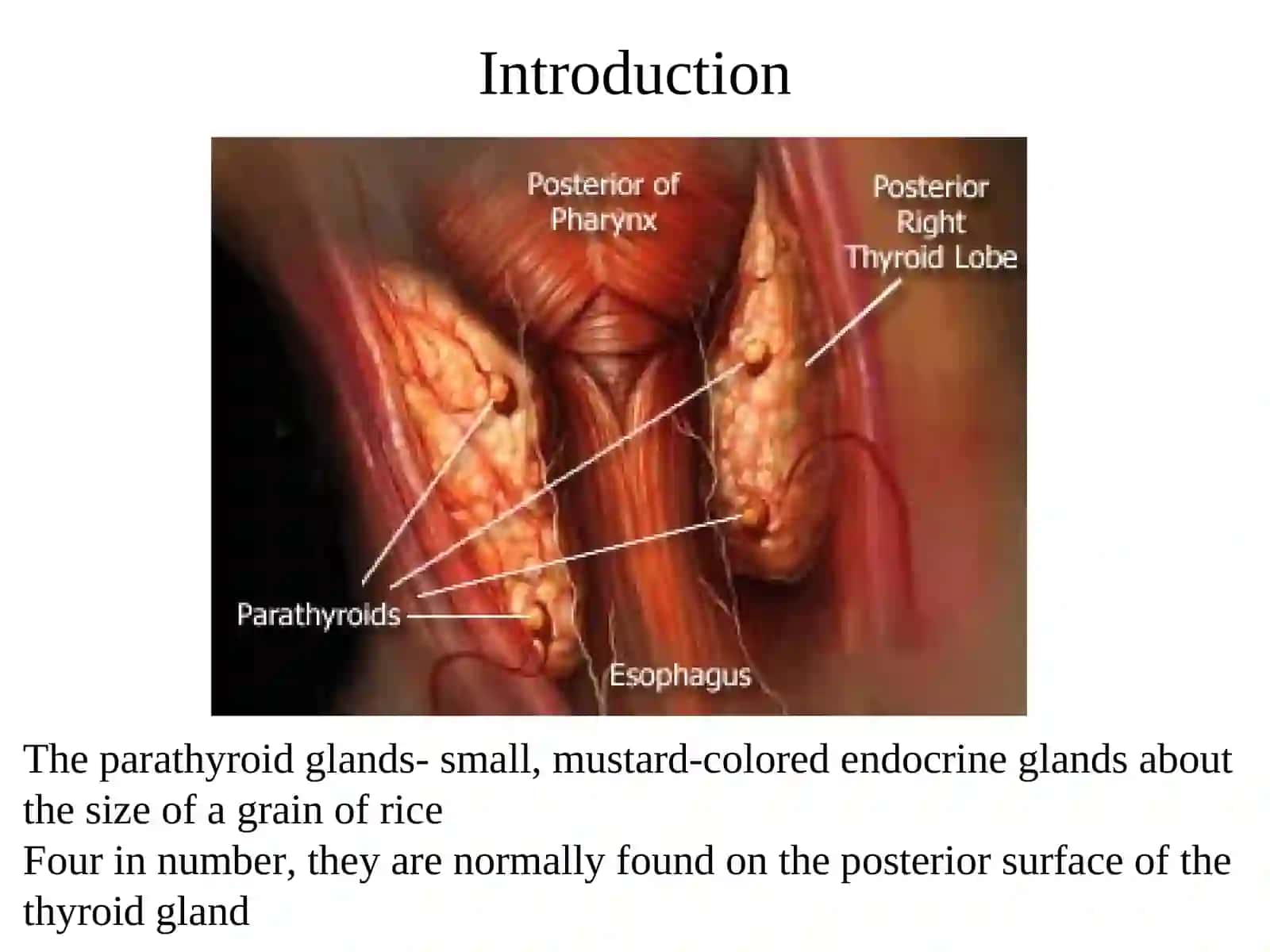 Parathyroid Disorders 3