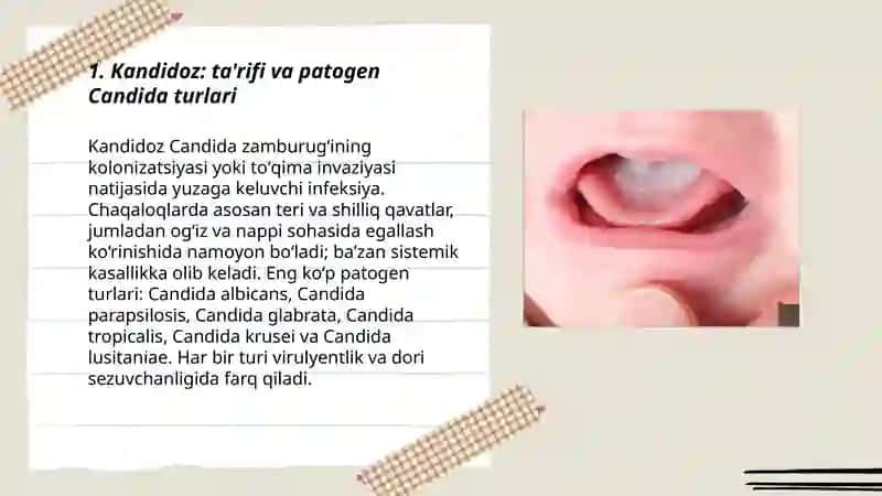 Chaqaloqlarda kandidozlar 3
