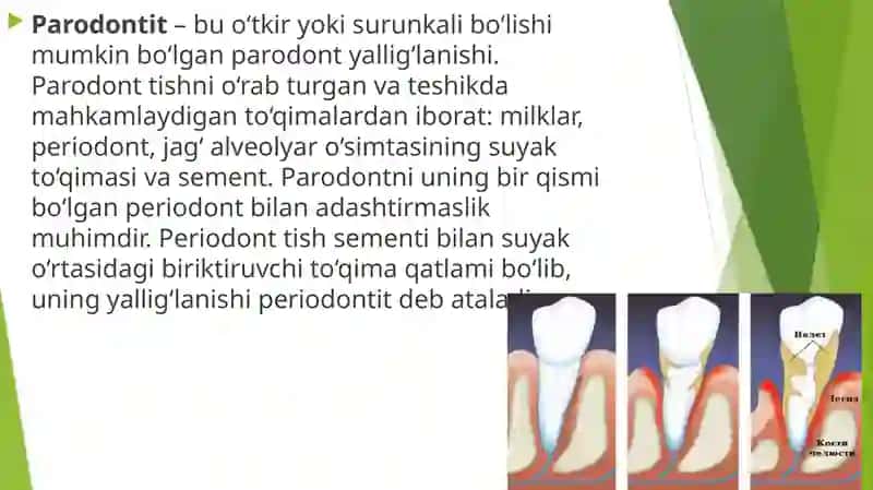 Paradont kasalliklarini ortopedik va jarrohlik davolash usullari 3