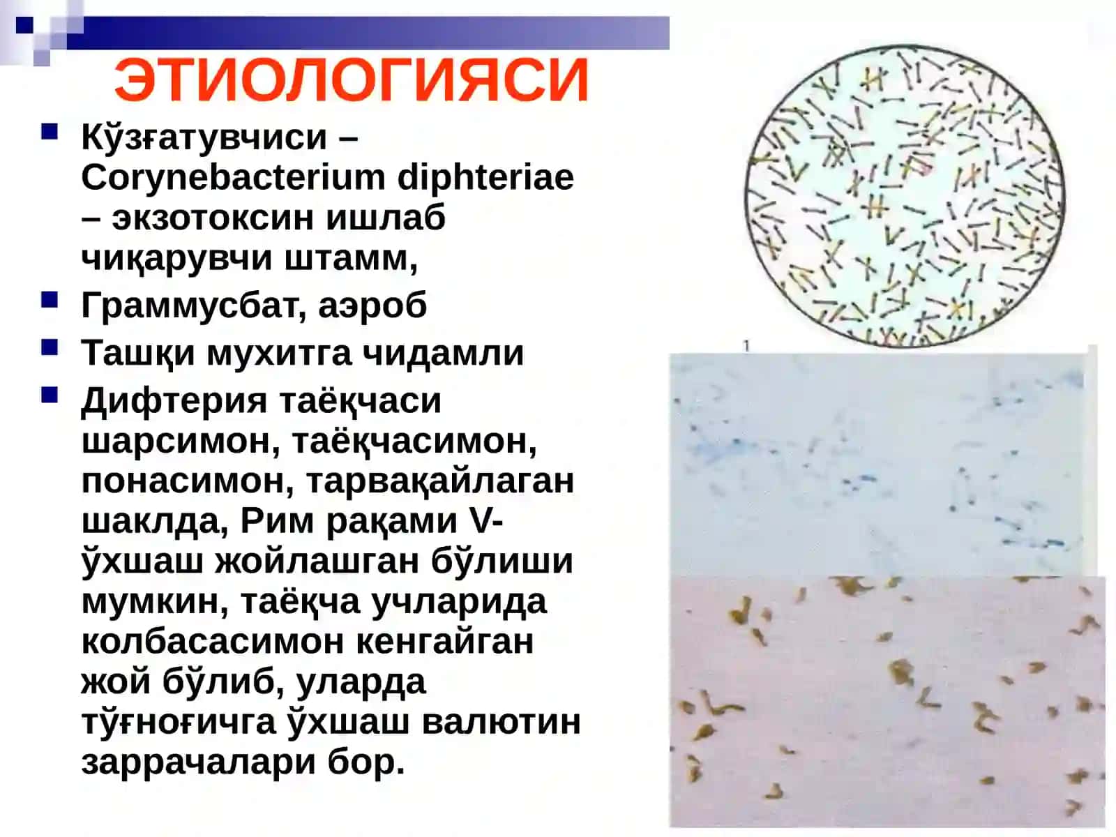 БЎҒМА – ДИФТЕРИЯ 3