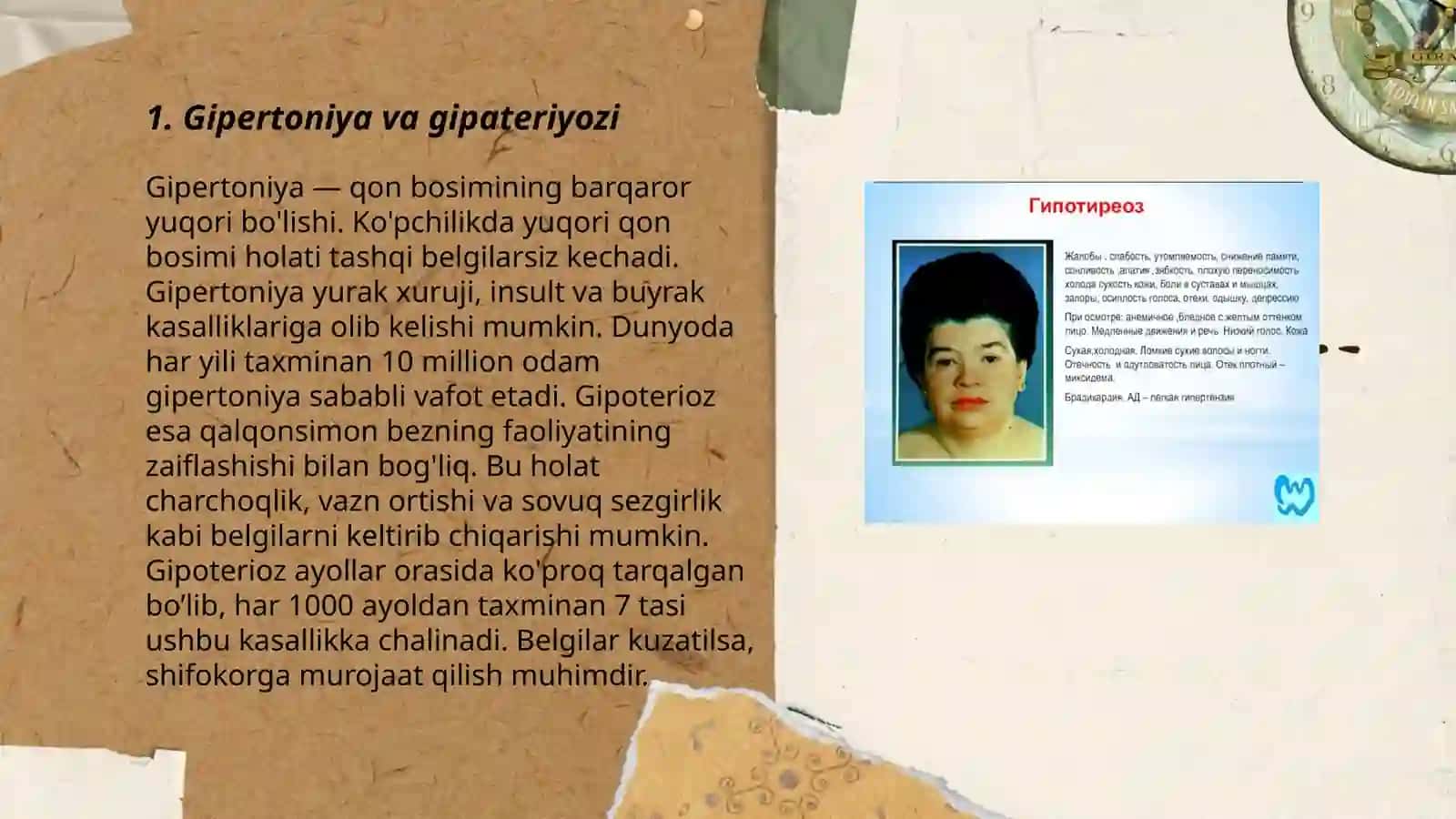 Gipateryoz 3