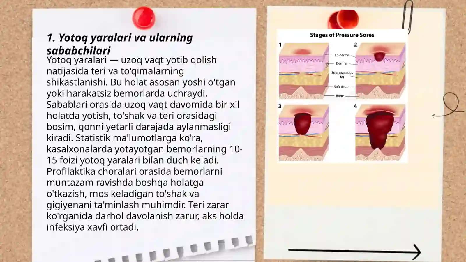 Yotoq yaralar profilaktikasi va davolash 3