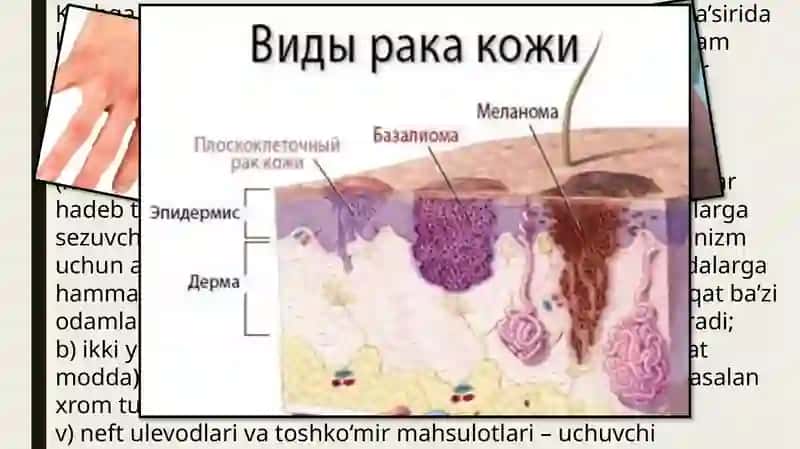 Kasbga aloqador dermatozlar 3