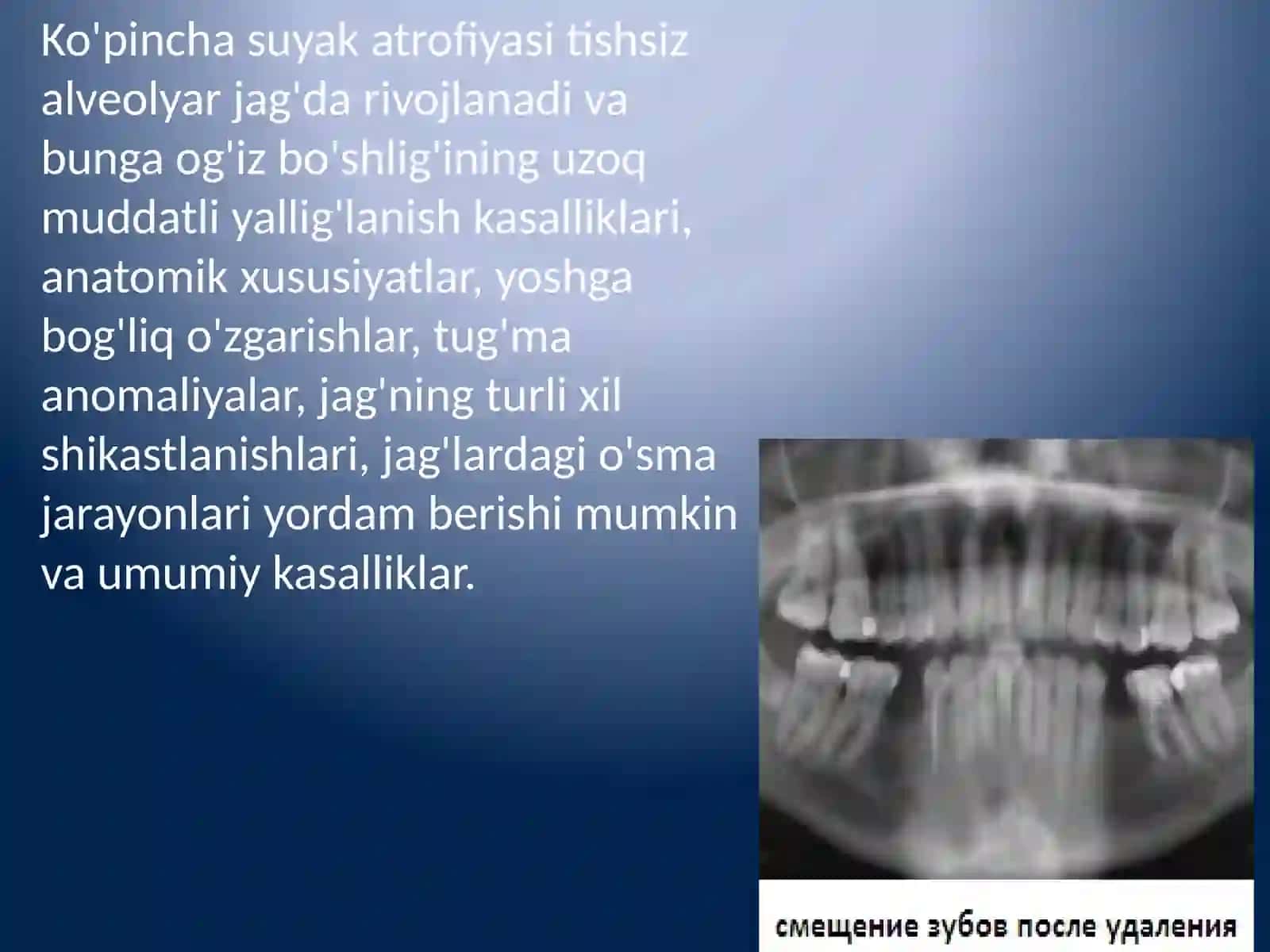 Jag' suyagi atrofiyasi 3