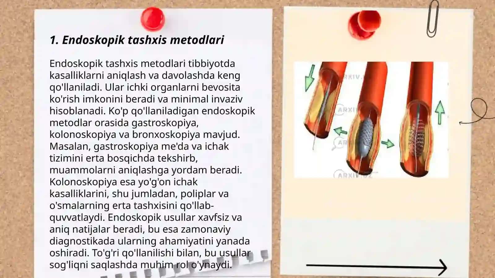 Endoskopik tashxis metodlari 3