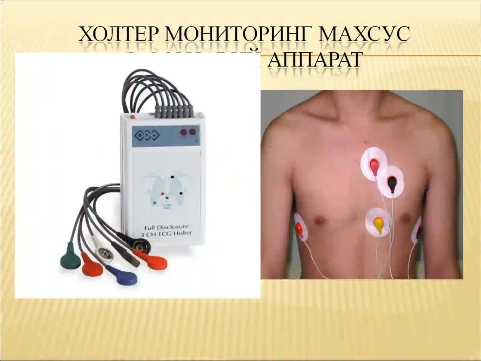 юрак касалликлари замонавий текшириш усуллари 3