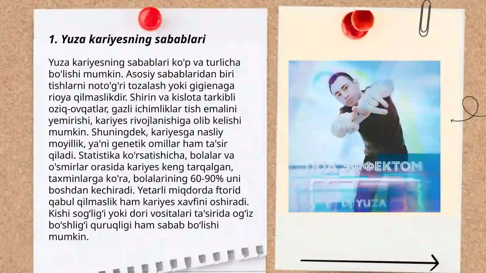 Yuza kariyes 3