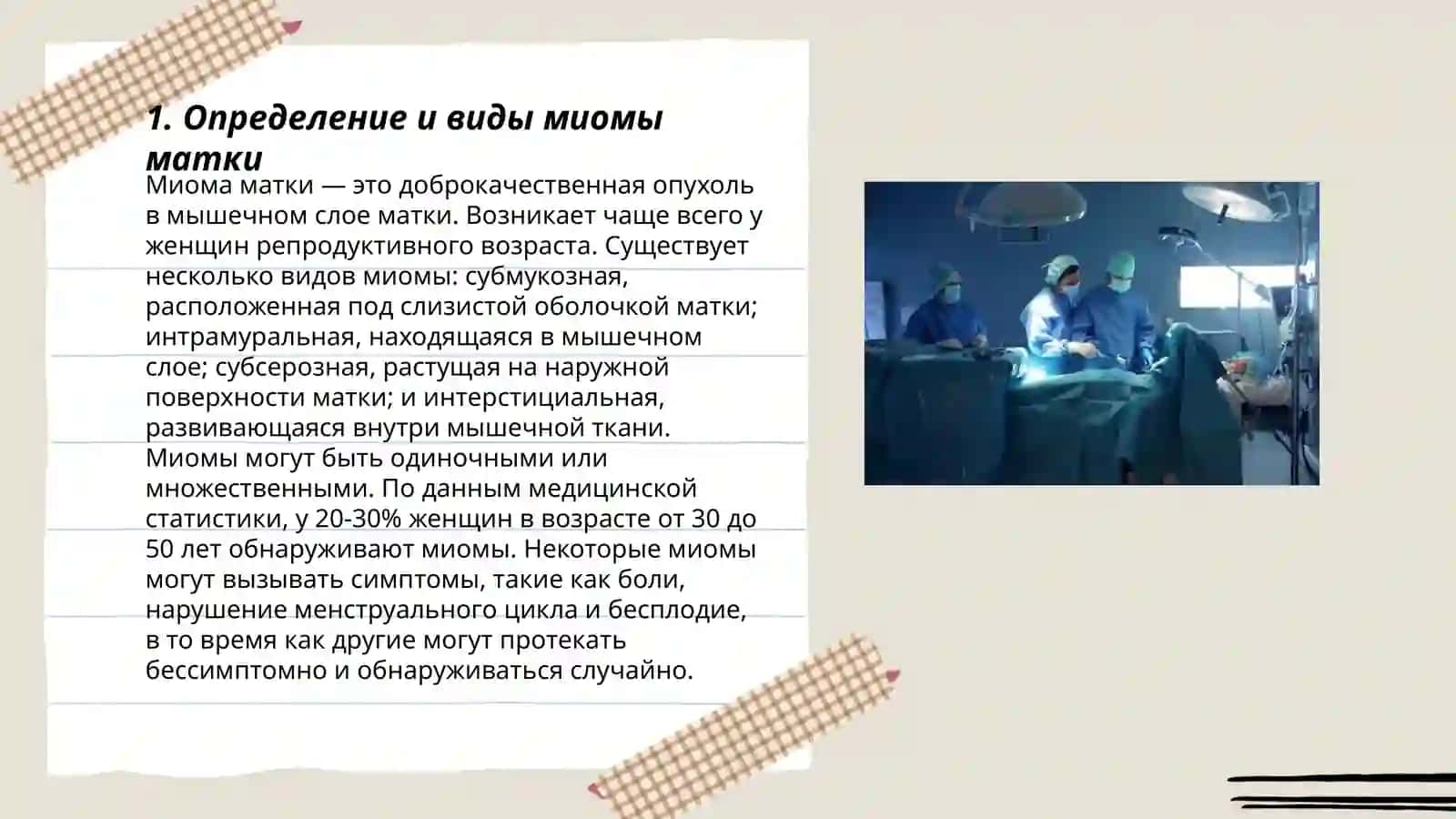 Миома матки 3