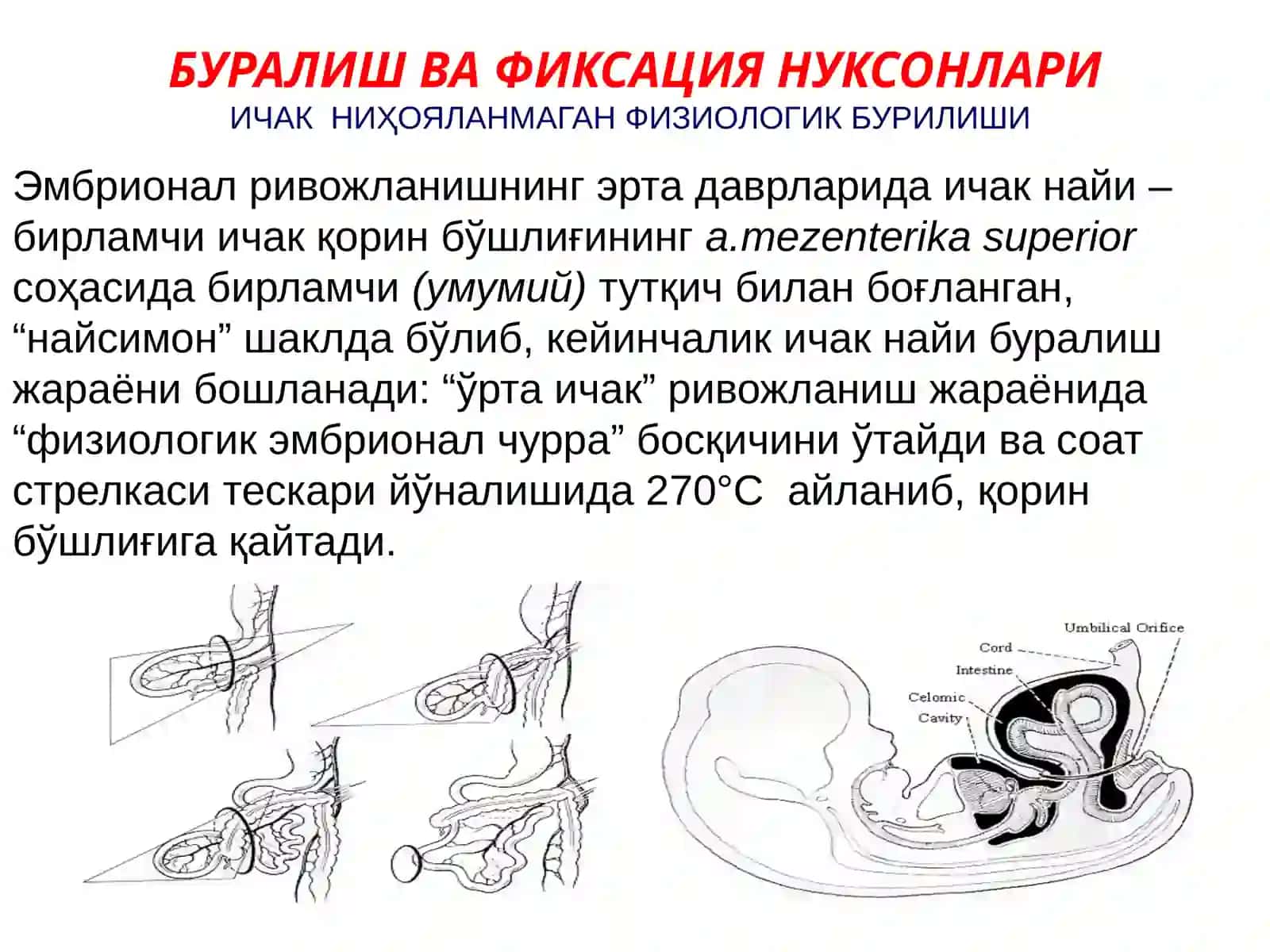 Қорин олд девори, қорин-парда қин ўсимтасининг ривожланиш нуқсонлари ва аномалиялари 3