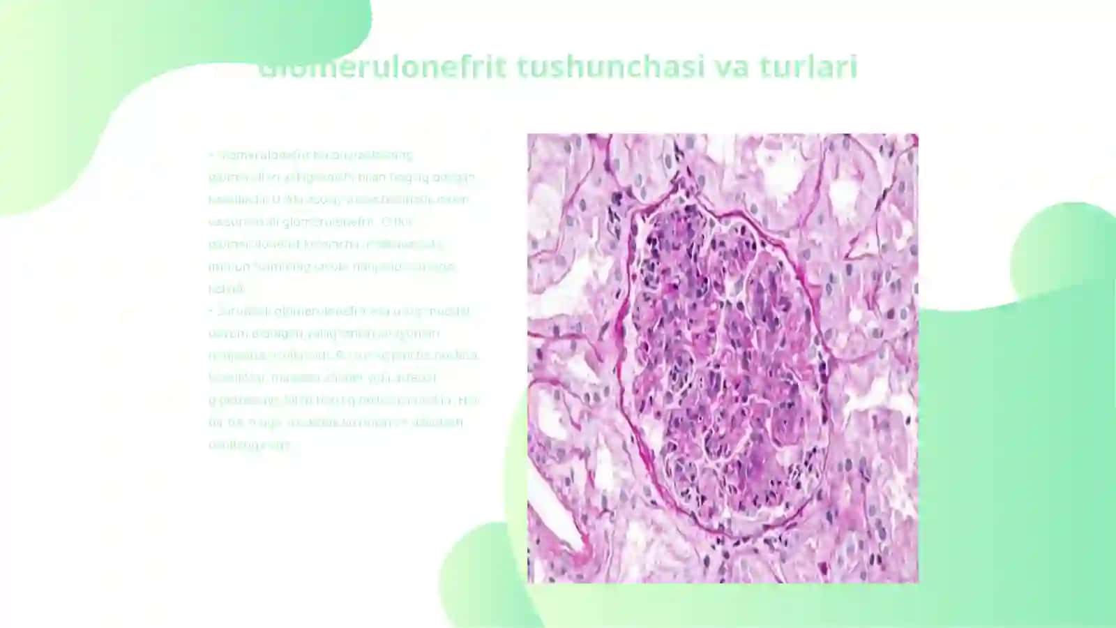 Otkir va surunkali glomerulonefrit 3