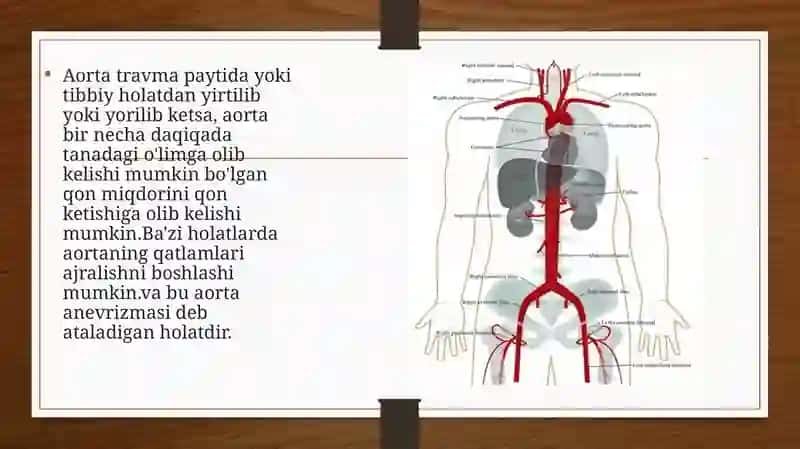 Aortavaaortaanevrizmasi 3
