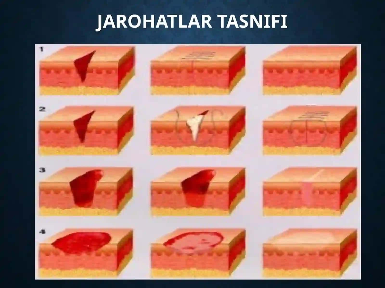 MEXANIKJAROHATLANISH 3