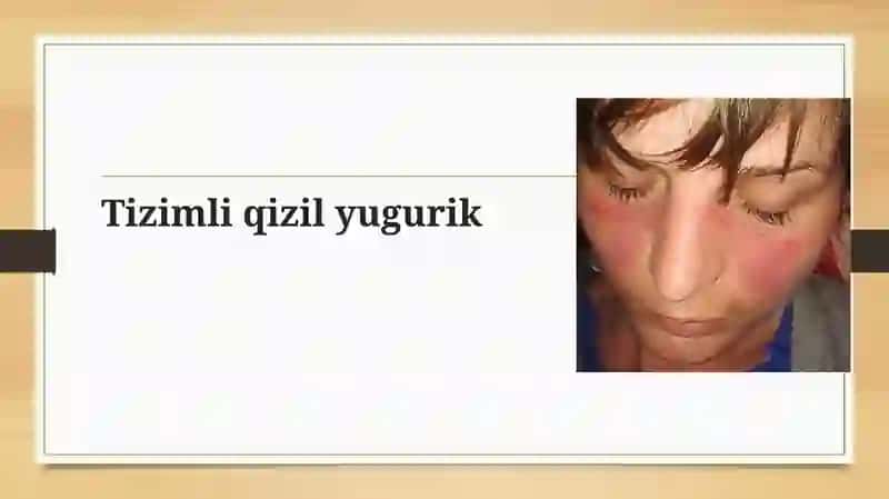 Tizimli qizil yugurik 3
