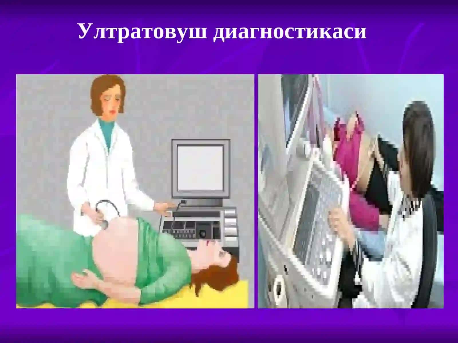 Ноионлаштирувчи нур ташхисоти усуллари 3