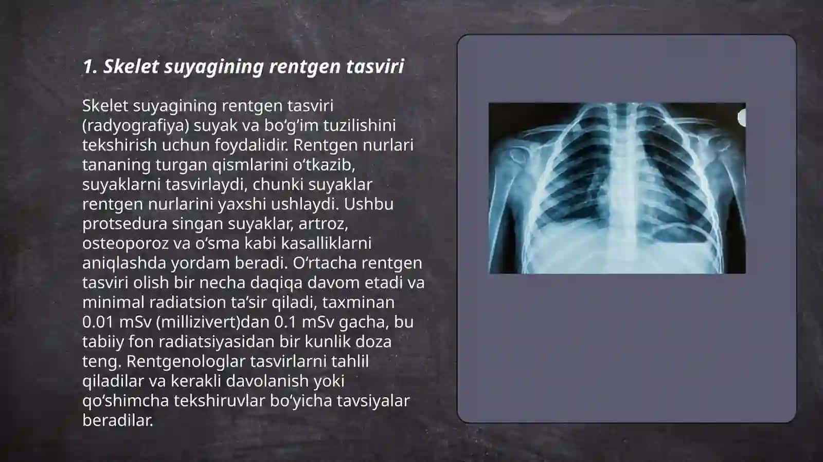 Skelet suyaklarining rentgenanatomiyasi 3