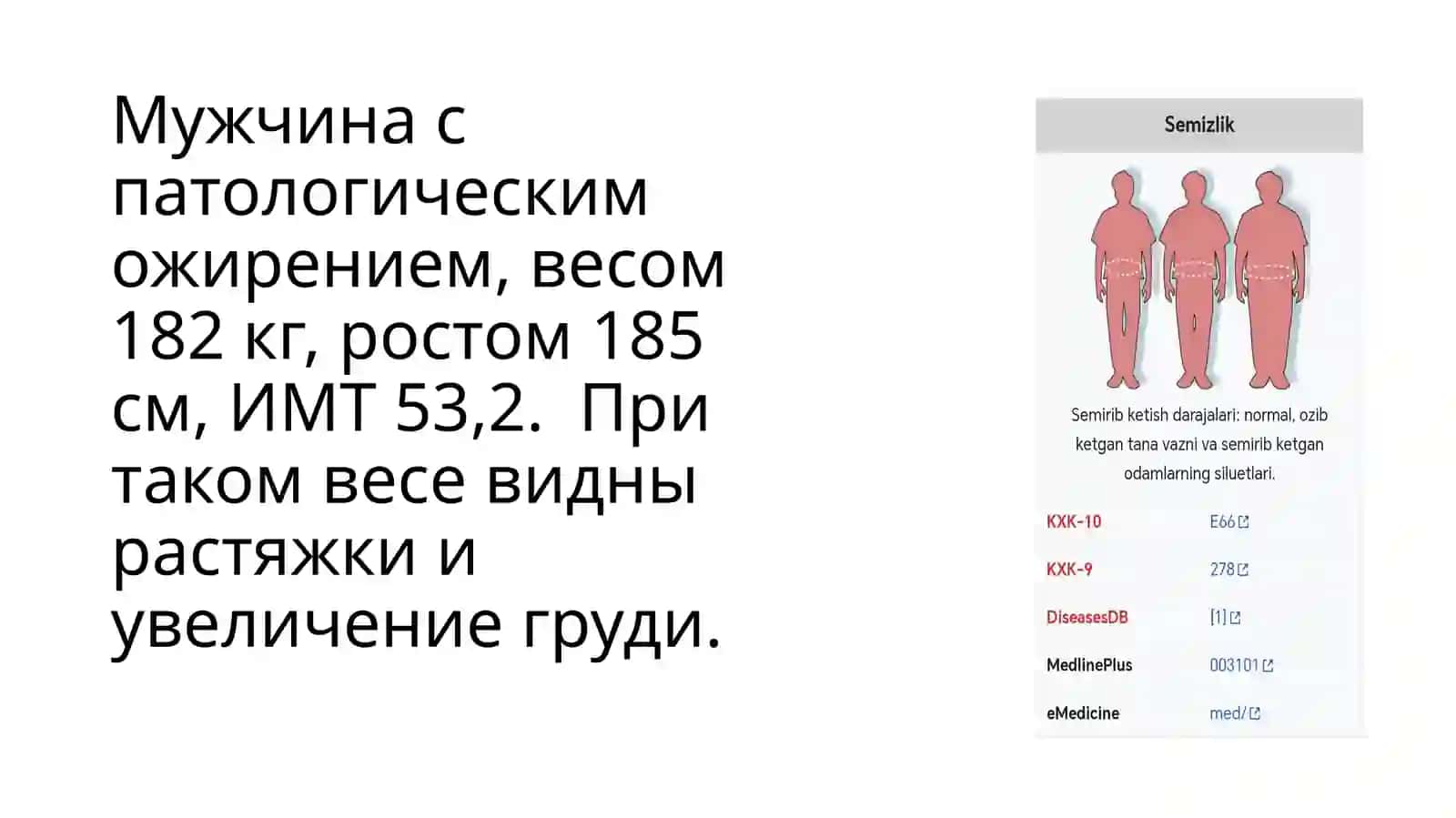 Избыточная масса тела 3