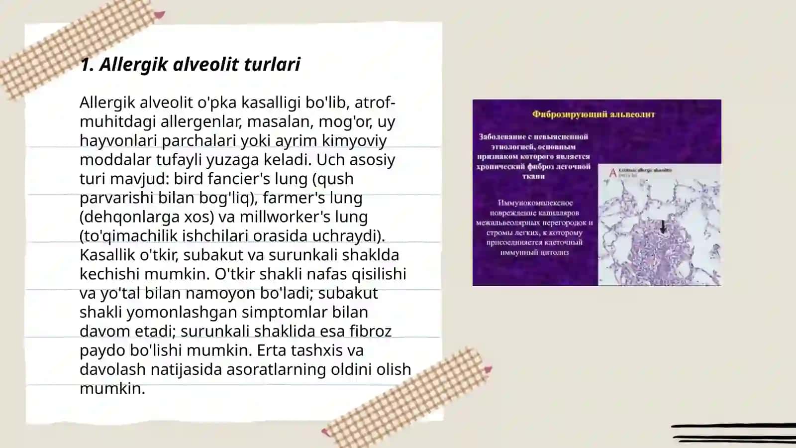 Allergik alveolit 3