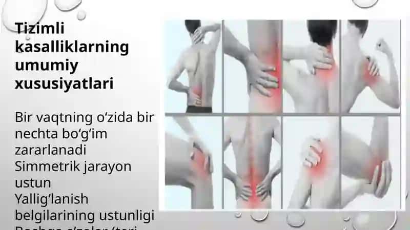 suyak va bo‘g‘imlarning tizimli kasalliklari 3
