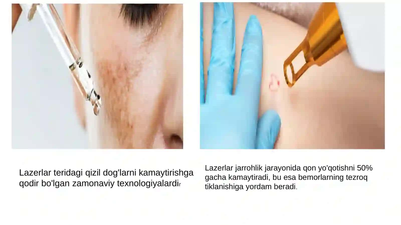 Lazerning Tibbiyotda Qoʻllanilishi 3