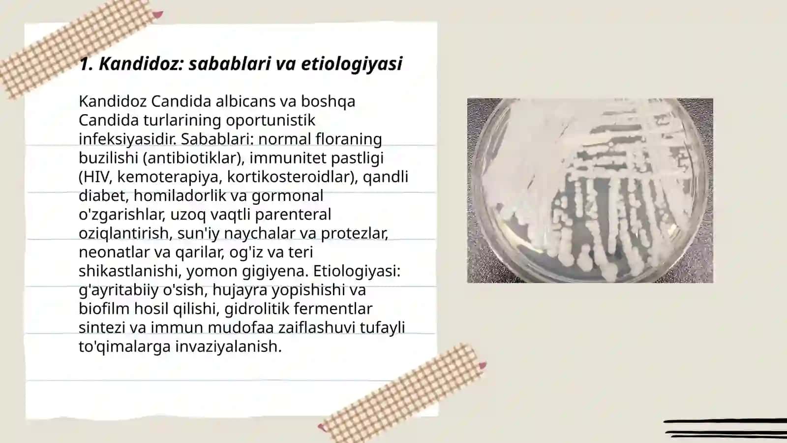 Zamburug' infeksiyalari (kandidoz, aspergillez) 3