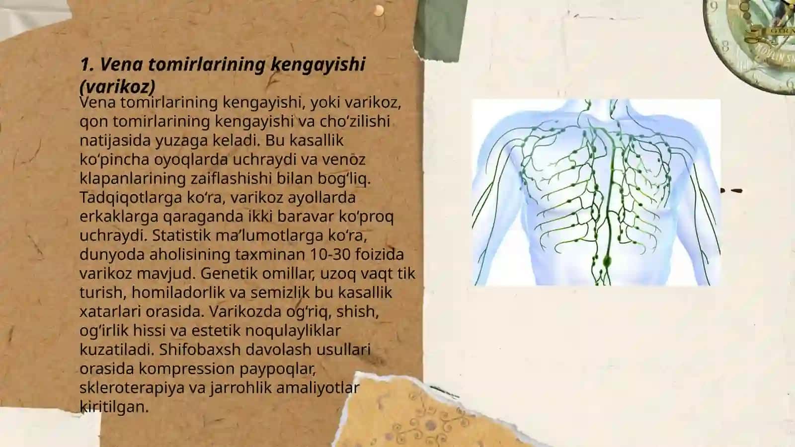 Vena va limfa tomirlari patalogiyasi 3