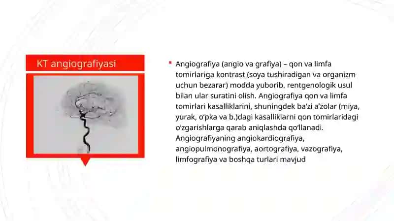 Kompyuter tomografiyasi 3