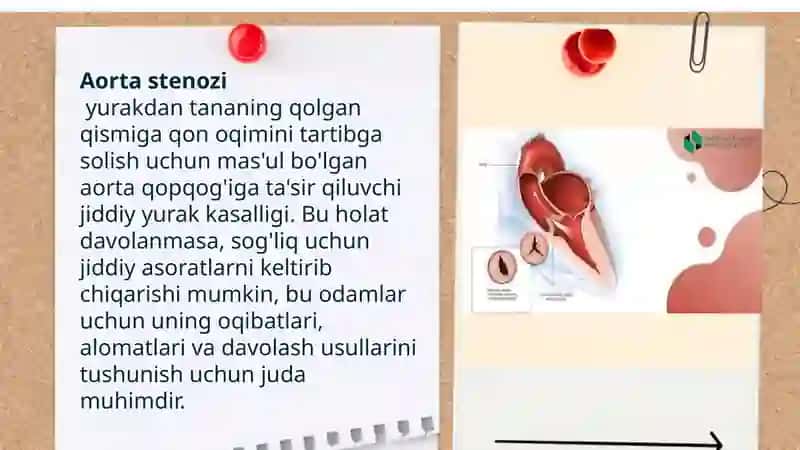 Aortal klapn yetishmovchiligi va stenozi etiologiyasi 3