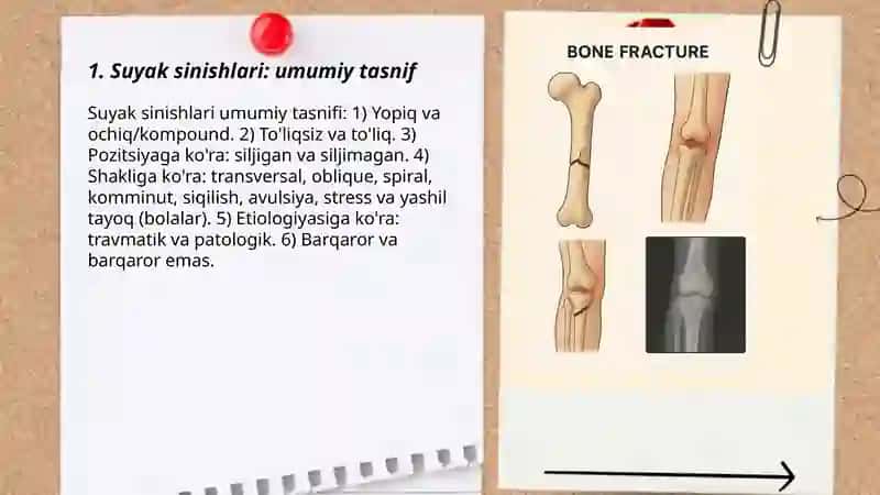Suyak sinishi turlari va birinchi yordam 3