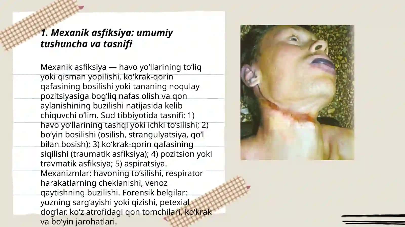 Mexanik asfiksiya 3