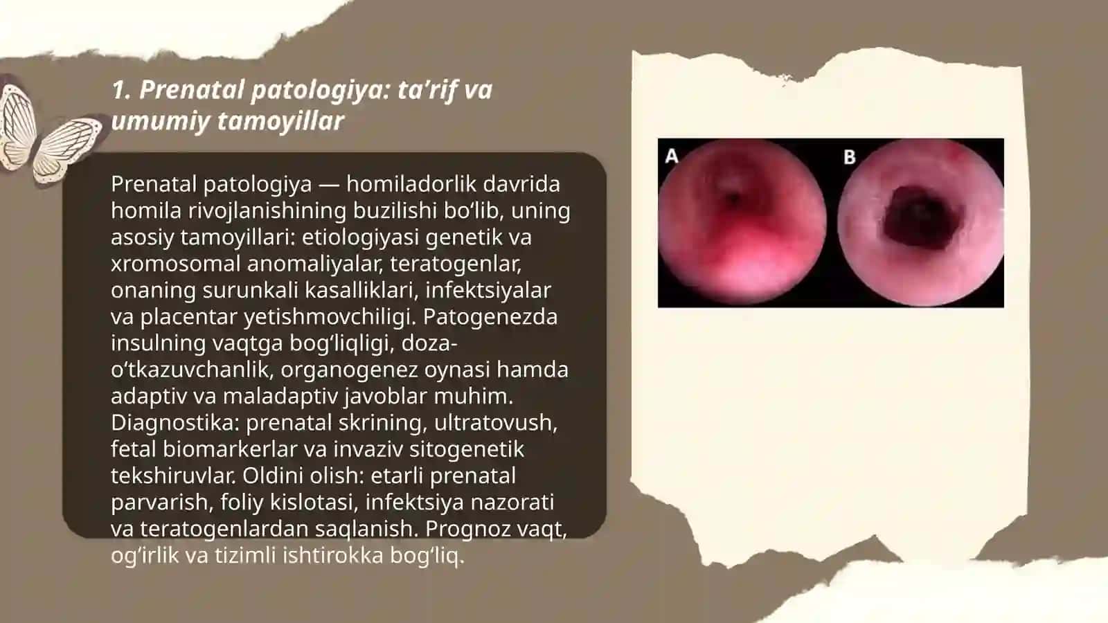 Prenatal patalogiya 3