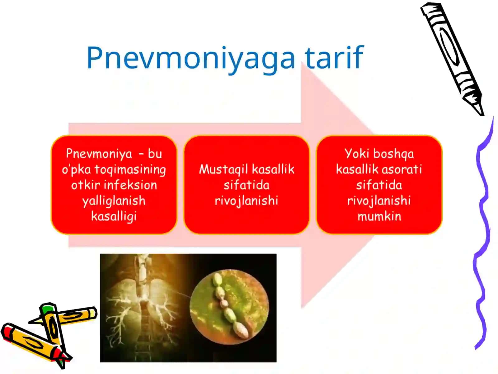 Infeksion genezli nafas a’zolar kasalliklari.Chaqaloqlar pnevmoniyasi 3