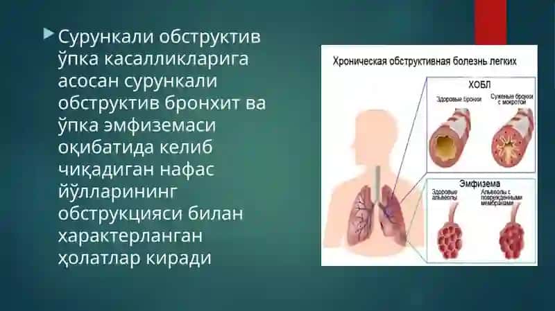 O'pkaning surunkali obstruktiv kasalliklari 3