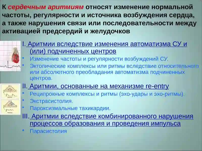 ЭКГ диагностика аритмий 3