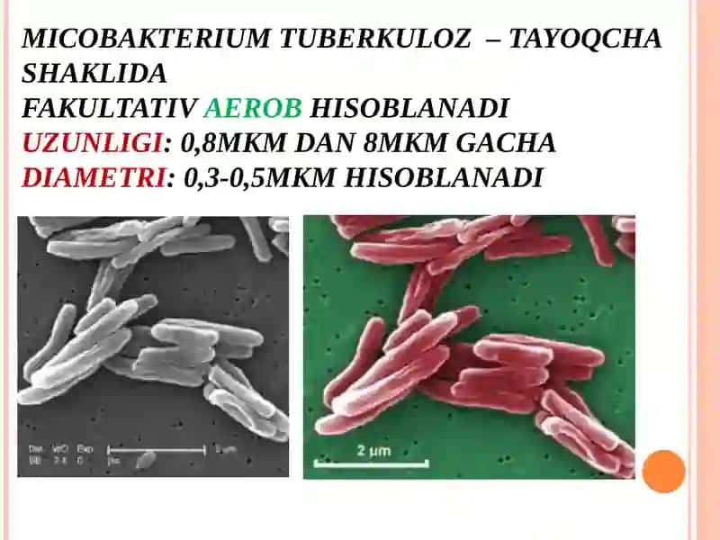 Tuberkuloz (SIL) 3